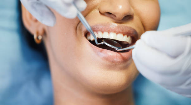 Best Teeth Whitening  in Ainaloa, HI